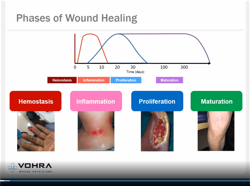 Wound Healing Learn How Wounds Heal Vohra Wound Care