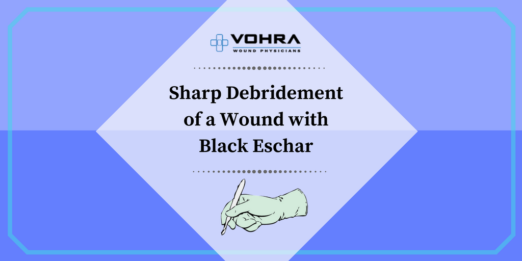 Wound with Black Eschar | Vohra Wound Physicians