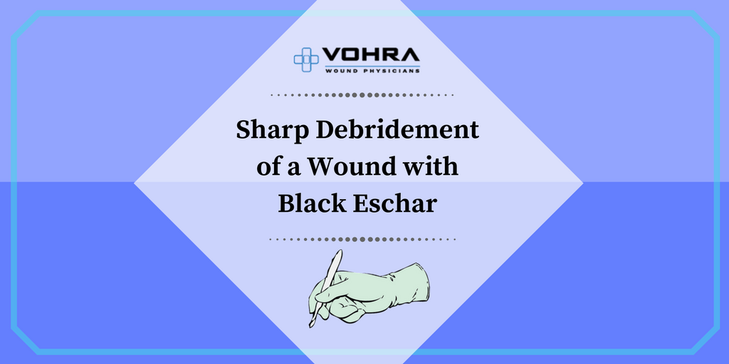 Wound with Black Eschar | Vohra Wound Physicians