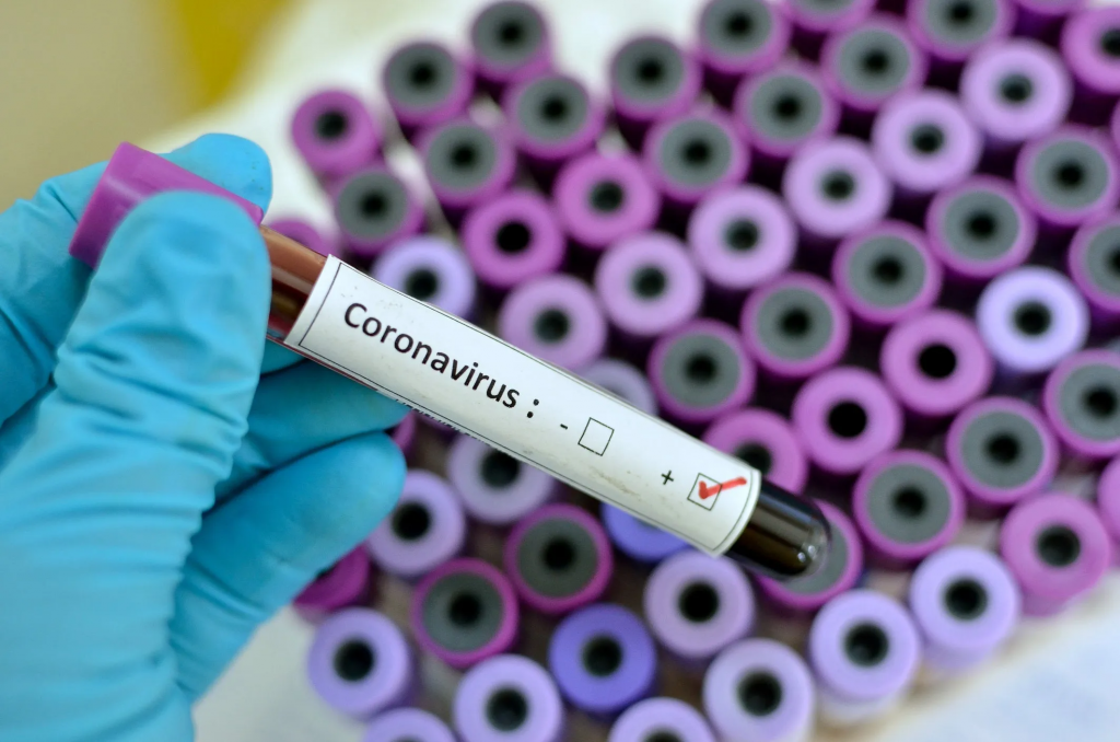 Coronavirus or COVID-19 Droplet Precautions