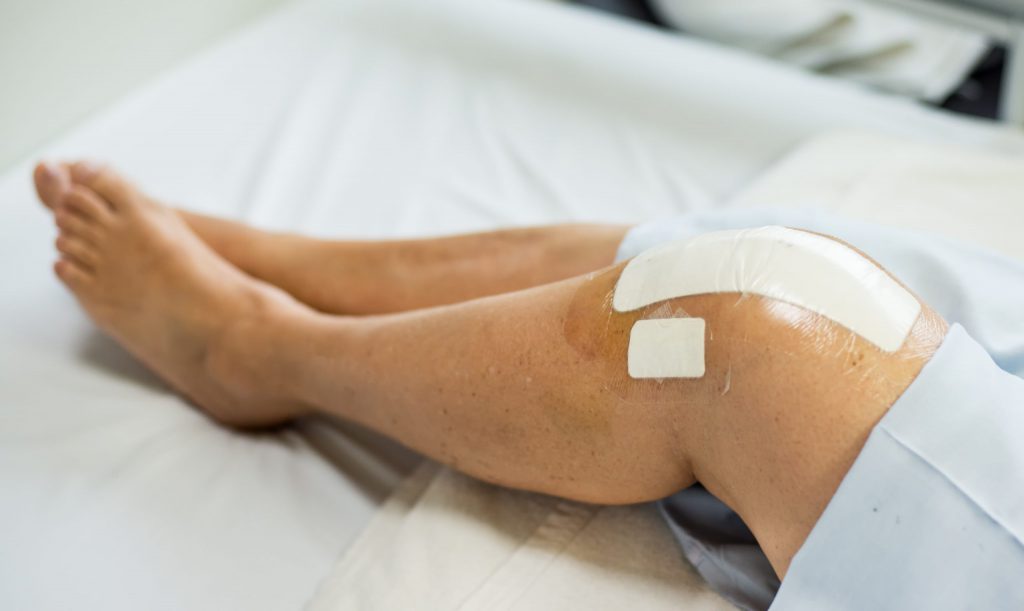 Bandaged patients with leg injuries