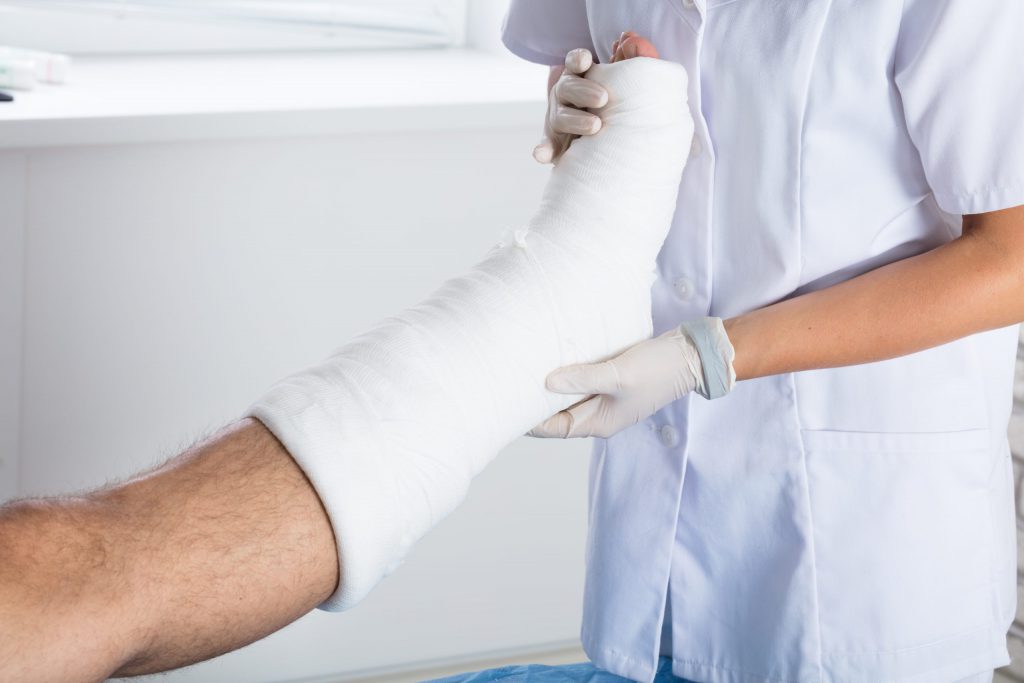 Nurse Taking Care of Patient's Wounded leg